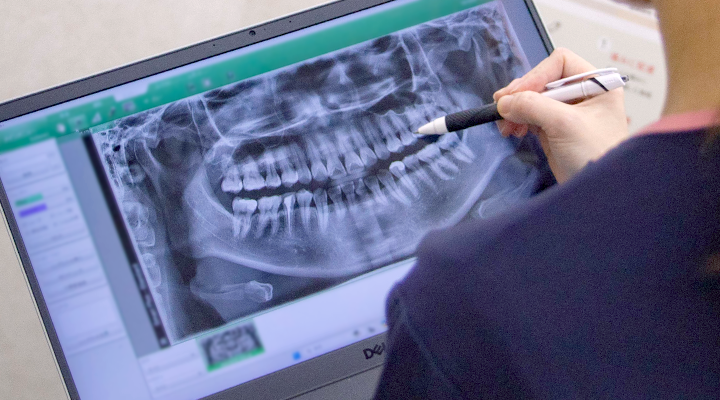 レントゲンの様子