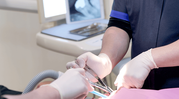 親知らずの抜歯治療風景