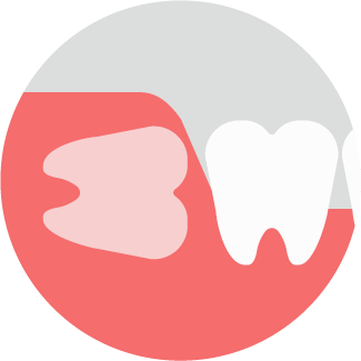 水平埋伏智歯イラスト