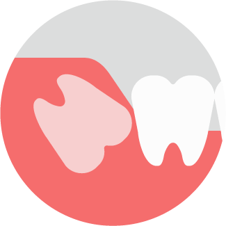 逆性埋伏智歯イラスト