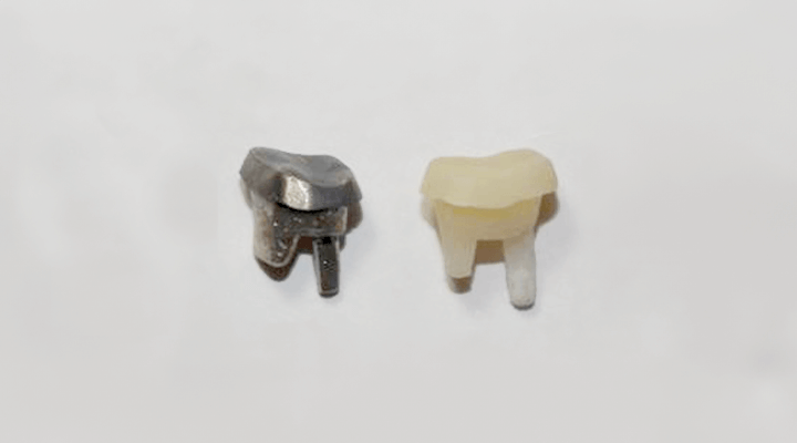 土台（コア）の素材写真「メタルコア」「ファイバーコア」