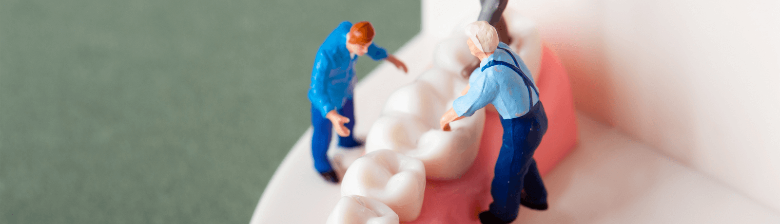 セラミック治療イメージ画像