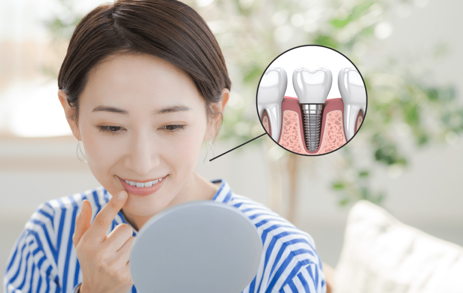インプラント治療のイメージ写真