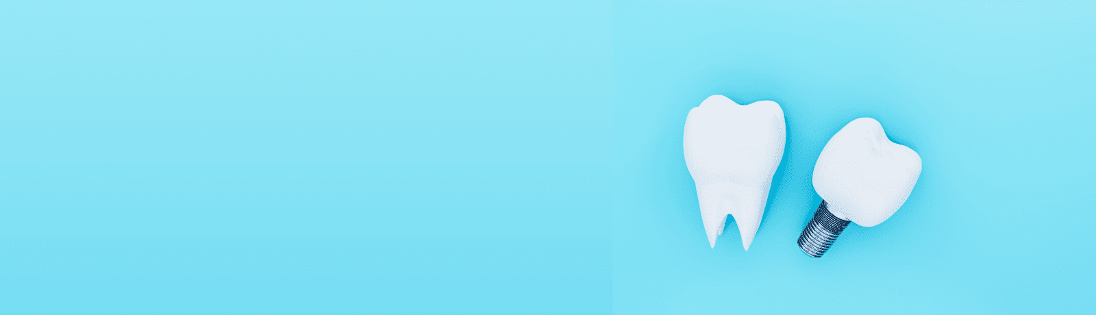 インプラント メインビジュアル