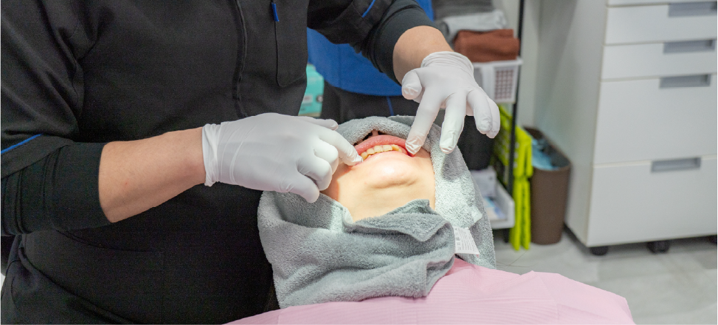 お口の中の検査の画像