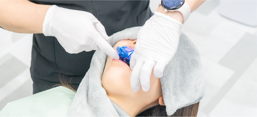 お口の撮影・歯の型取りの画像