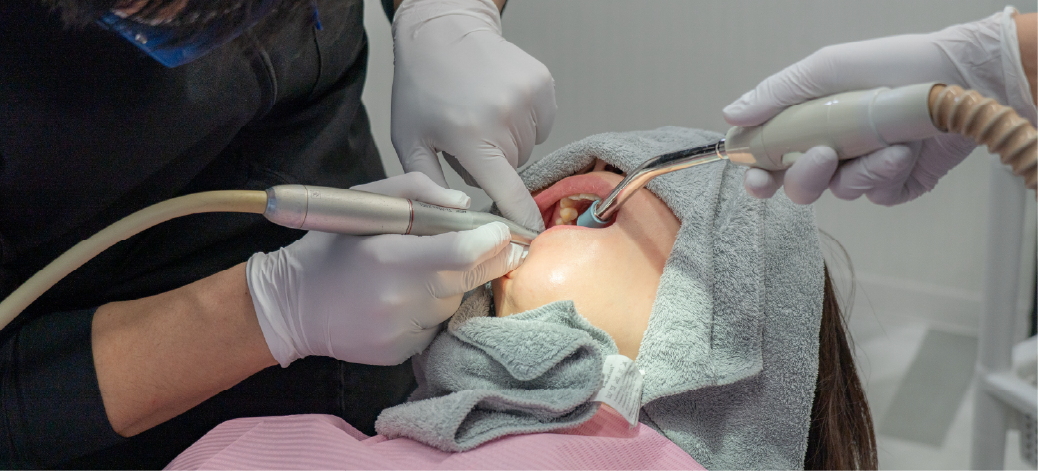 お口の状況に合わせて、歯の側面を削って調整している画像