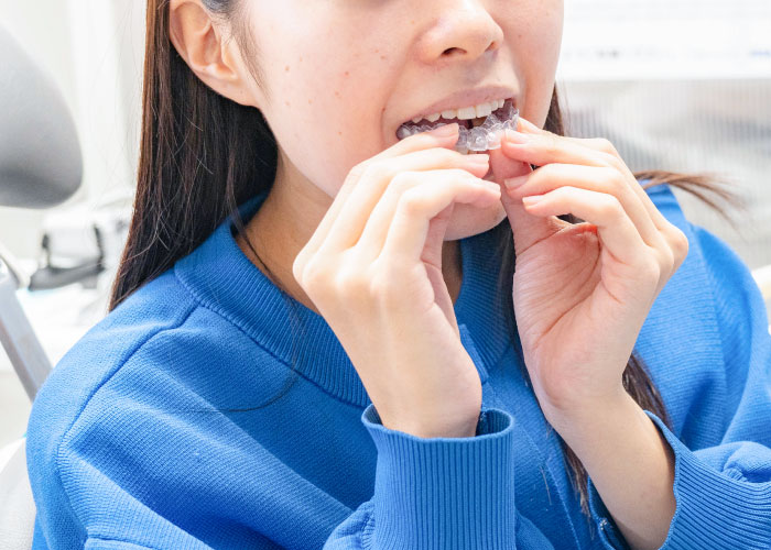 マウスピース矯正のイメージ写真