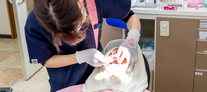 マウスピース用の型取り