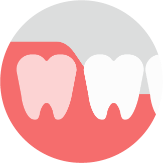 完全埋伏智歯イラスト
